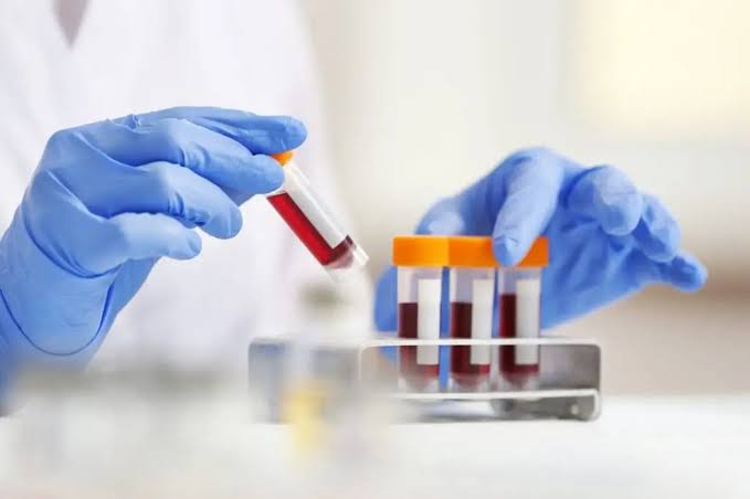The Ultimate Guide to Blood Tests in Dubai: Everything You Need to Know