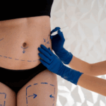 Top 5 Most Popular Plastic Surgery Procedures in Dubai