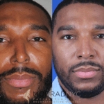 The Role of Reconstructive Surgery in New York in Restoring Lives