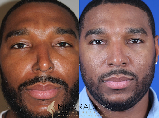 The Role of Reconstructive Surgery in New York in Restoring Lives